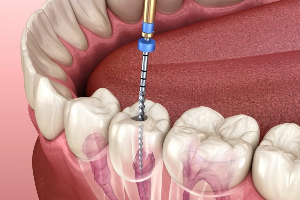 Discover more about our Dental Clinic in india—expert care, advanced technology, and a patient-first approach for all ages.
