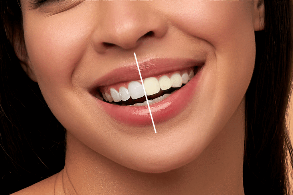 Discover more about our Dental Clinic in india—expert care, advanced technology, and a patient-first approach for all ages.