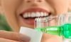 Antimicrobial Rinses Antimicrobial Rinses