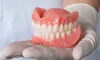 Complete Dentures