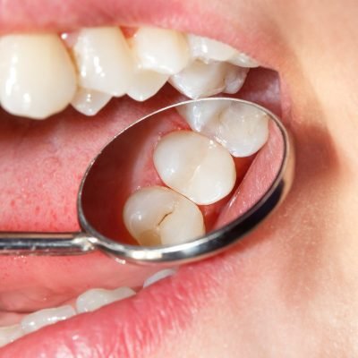 Discover more about our Dental Clinic in india—expert care, advanced technology, and a patient-first approach for all ages.