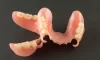 Flexible Dentures