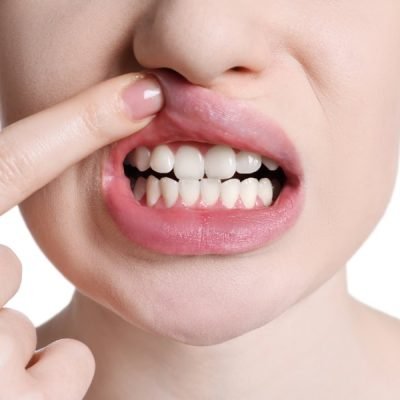 Discover more about our Dental Clinic in india—expert care, advanced technology, and a patient-first approach for all ages.