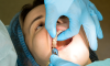 Experience stress-free wisdom teeth removal at The Family Dental Clinics. Expert care, minimal discomfort, and fast recovery!