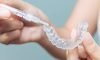 Take-Home Whitening Kits