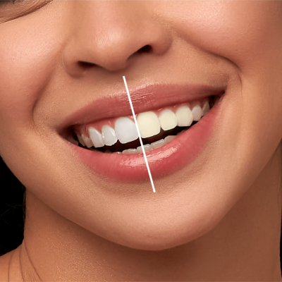 Discover more about our Dental Clinic in india—expert care, advanced technology, and a patient-first approach for all ages.